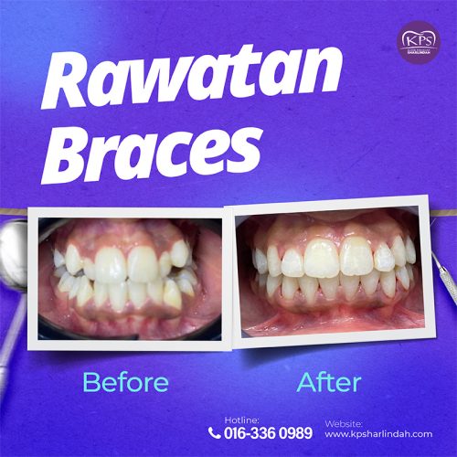Ortho Before After 2025-01