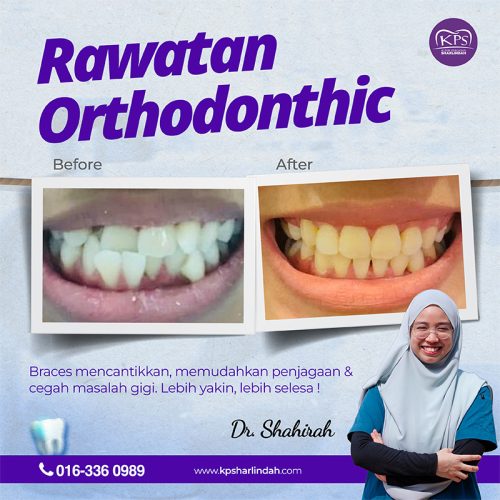 Ortho Before After 2025-02