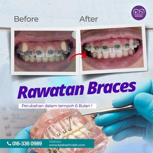 Ortho Before After 2025-03